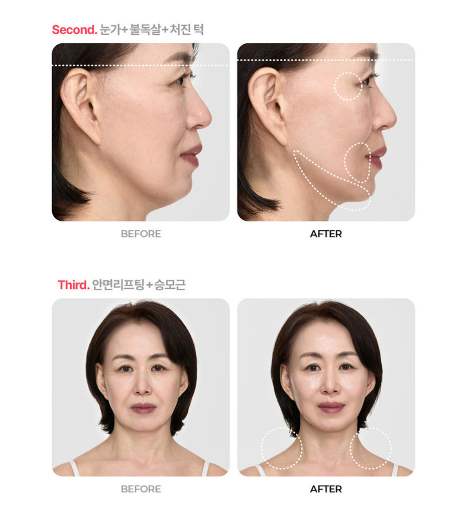 Volexy Body Shot Pro & Scalp Shot Pro