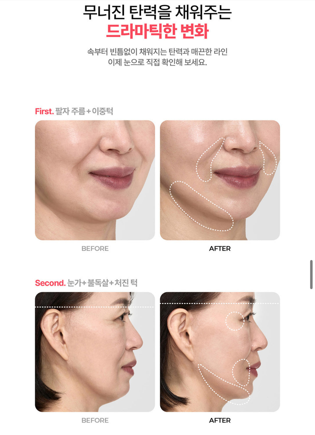 Volexy Body Shot Pro & Scalp Shot Pro