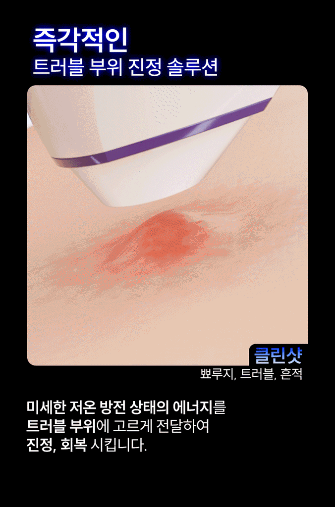 SIXKIN Skin Trace Eraser Vocaino Shot_Promotion