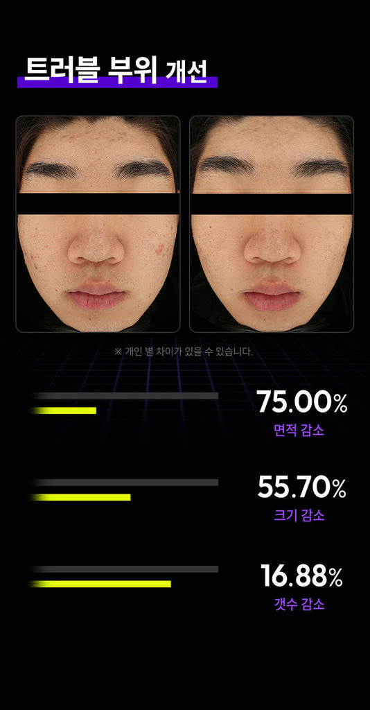SIXKIN Skin Trace Eraser Vocaino Shot_Promotion