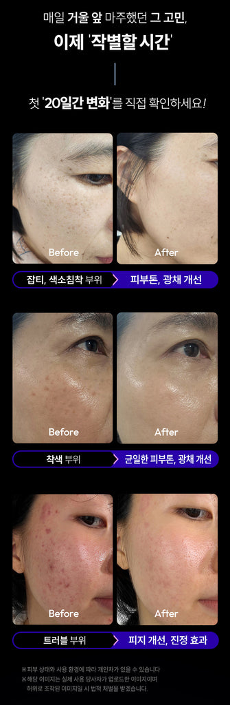 SIXKIN Skin Trace Eraser Vocaino Shot_Promotion